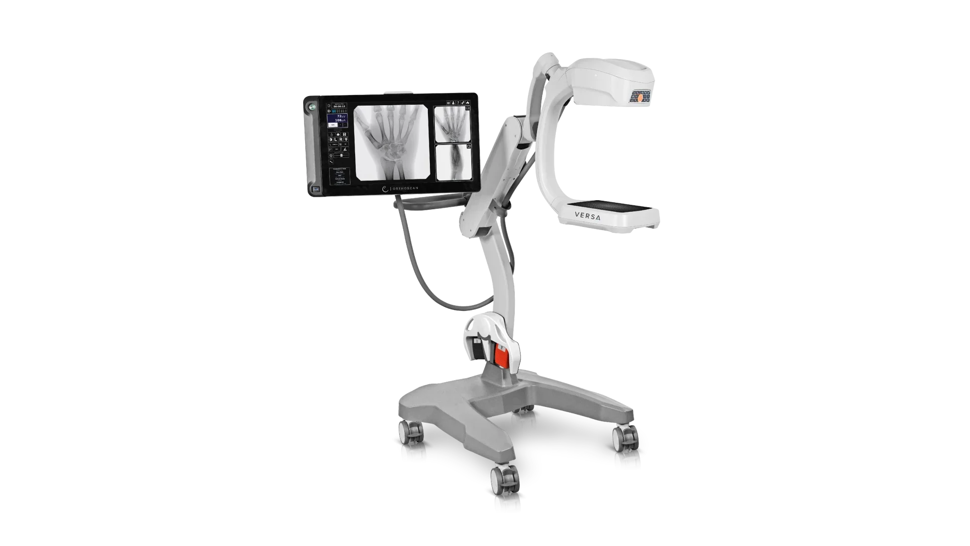Orthoscan VERSA